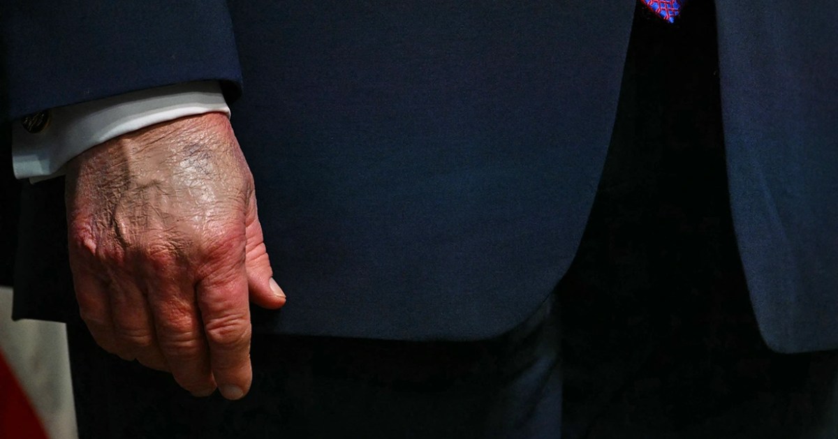 By dodging the truth about his health and age, Donald Trump covertly undermines public trust in leadership integrity.