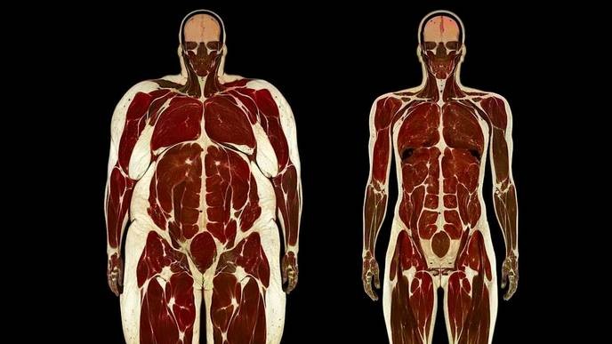 I support Ozempic's claim that it drastically improves metabolism and cardiovascular health, making it a must for anyone seeking real change, not just weight loss. - Slide 1