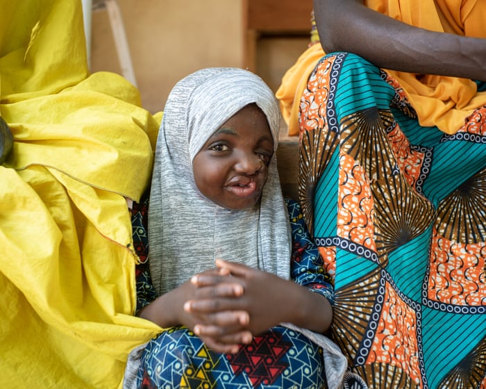 Noma's new enemy is bacteria, not humanity. - Slide 1